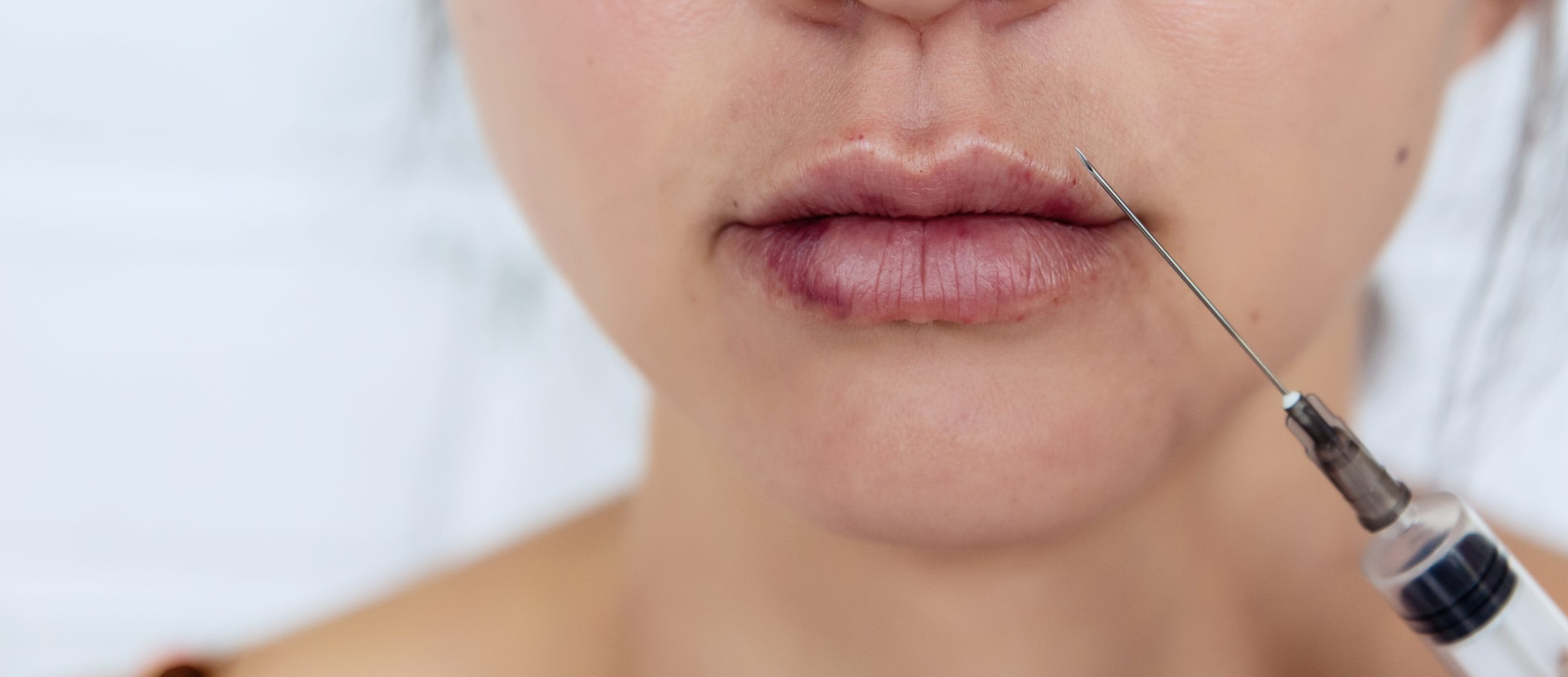 Vascular Occlusion On The Lip